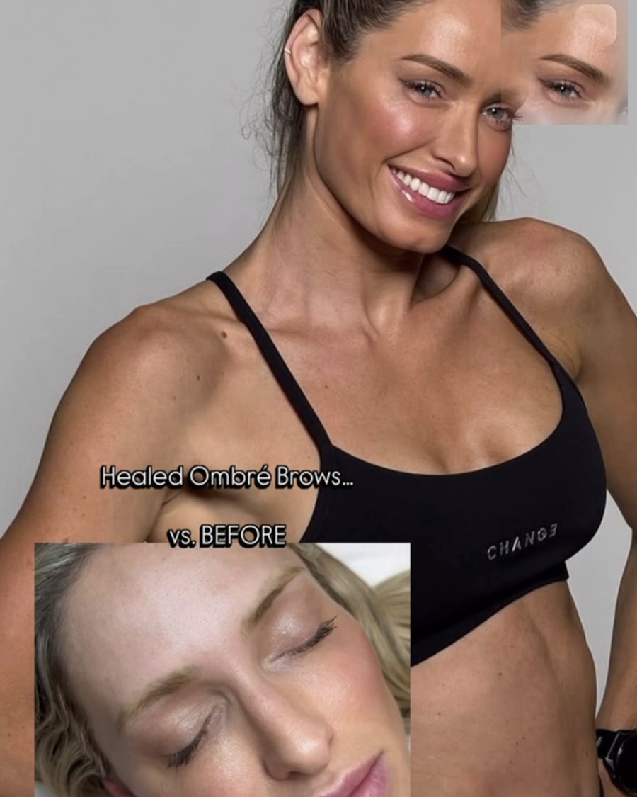 Pigment removal and correction result shown on a client