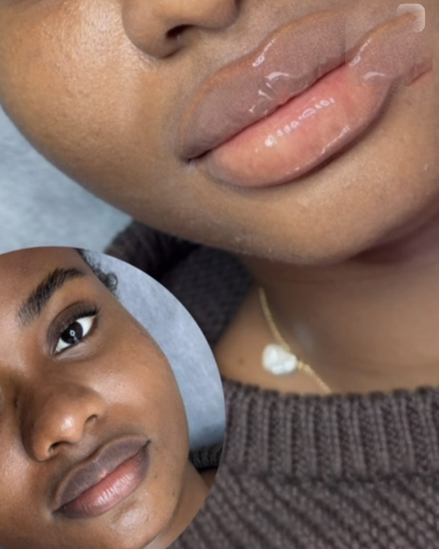 Dark lip neutralisation result showing an evened out lip tone